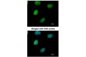 ICC/IF Image Immunofluorescence analysis of paraformaldehyde-fixed HeLa, using ITPK1, antibody at 1:200 dilution. (ITPK1 antibody)