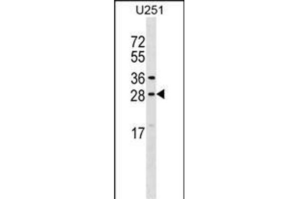 OSTF1 Antikörper  (N-Term)