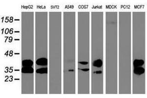 Image no. 5 for anti-Uracil-DNA Glycosylase (UNG) antibody (ABIN1501681) (UNG antibody)