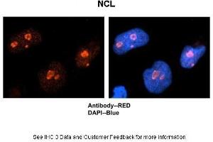Immunohistochemistry (IHC) image for anti-Nucleolin (NCL) (C-Term) antibody (ABIN2778936)