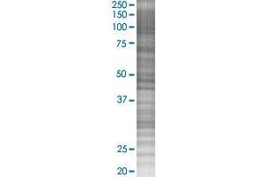 APOBEC3B transfected lysate. (APOBEC3B 293T Cell Transient Overexpression Lysate(Denatured))