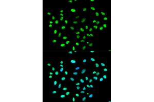 Immunofluorescence analysis of MCF-7 cells using HNRNPK antibody (ABIN5970850). (HNRNPK antibody)