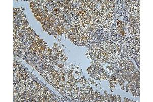 IHC analysis of PCSK9 using anti PCSK9 antibody (ABIN7600134).