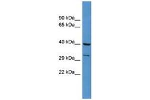 Image no. 1 for anti-Dual Specificity Phosphatase 11 (RNA/RNP Complex 1-Interacting) (DUSP11) (AA 41-90) antibody (ABIN6746189) (DUSP11 antibody  (AA 41-90))