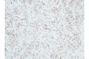 Image no. 1 for anti-gamma-Interferon-Induced Monokine (CXCL9) antibody (ABIN465878) (CXCL9 antibody)