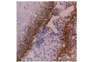 Cryostat section of human tonsil stained with anti-CD104 antibody ABIN118872 (Integrin beta 4 antibody)