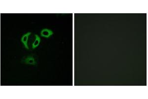 Immunofluorescence analysis of A549cells, using TACC3 antibody. (TACC3 antibody  (C-Term))