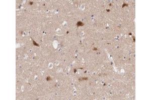 ABIN6266460 at 1/200 staining human Cerebellum tissue sections by IHC-P. (PAK3 antibody  (pSer154))