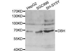 Western blot analysis of extracts of various cell lines, using DBH antibody. (DBH antibody  (AA 150-250))