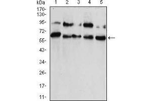 Western blot analysis using CBX2 mouse mAb against HUVEC (1), HEK293 (2), Hela (3), NIH/3T3 (4), and A431 (5) cell lysate. (CBX2 antibody  (AA 402-525))