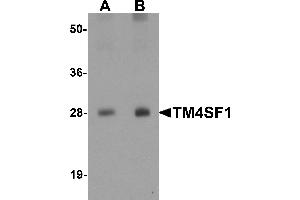 Western blot analysis of TM4SF1 in human lung tissue lysate with TM4SF1 antibody at (A) 0. (TM4SF1 antibody  (N-Term))