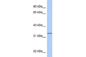 WB Suggested Anti-GSTO2 Antibody Titration:  0. (GSTO2 antibody  (Middle Region))