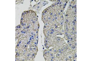 Immunohistochemistry of paraffin-embedded human stomach using CA9 antibody (ABIN6292666) at dilution of 1:100 (40x lens).