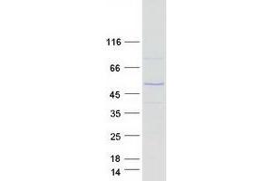 Western Blotting (WB) image for Paired Box 5 (PAX5) protein (Myc-DYKDDDDK Tag) (ABIN2728322)
