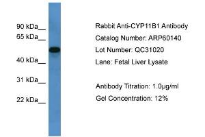 WB Suggested Anti-CYP11B1  Antibody Titration: 0.