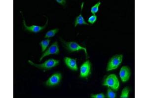 Immunofluorescent analysis of A549 cells using ABIN7152727 at dilution of 1:100 and Alexa Fluor 488-congugated AffiniPure Goat Anti-Rabbit IgG(H+L) (FATE1 antibody  (AA 1-162))