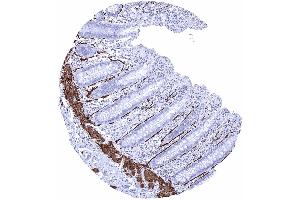 Appendix mucosa Intense caldesmon h positivity of intestinal subepithelial myofibroblasts ISEMFs and of the muscularis mucosae Caldesmon h immunohistochemistry (Recombinant Caldesmon antibody)