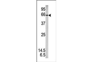 Image no. 1 for anti-Signal Transducer and Activator of Transcription 1, 91kDa (STAT1) (pSer727) antibody (ABIN358231) (STAT1 antibody  (pSer727))