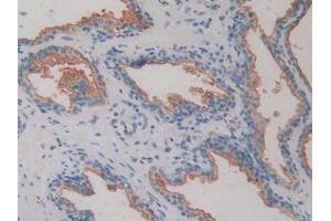 IHC-P analysis of Human Prostate Gland Tissue, with DAB staining. (DPP4 antibody  (AA 484-728))