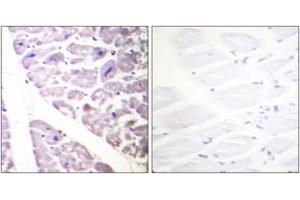 Immunohistochemistry analysis of paraffin-embedded human heart, using IKK-alpha (Phospho-Ser176) /IKK-beta (Phospho-Ser177) Antibody. (IKK alpha antibody  (pSer176))