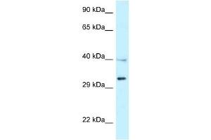 Western Blot showing TNFRSF14 antibody used at a concentration of 1 ug/ml against NCI-H226 Cell Lysate (HVEM antibody  (Middle Region))