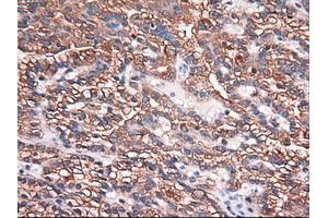 Image no. 1 for anti-Carboxypeptidase A1 (Pancreatic) (CPA1) (AA 1-419) antibody (ABIN1490771)