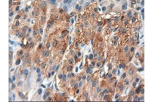 Image no. 1 for anti-Patched 1 (PTCH1) (AA 122-436) antibody (ABIN1490887) (Patched 1 antibody  (AA 122-436))