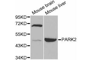 Western blot analysis of extracts of various cell lines, using PARK2 antibody (ABIN4904678) at 1:1000 dilution. (Parkin antibody)