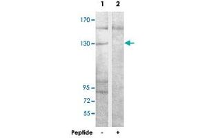 Western blot analysis of extracts from COLO 205 cells, using ADCY1 polyclonal antibody . (ADCY1 antibody)
