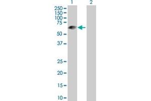 Western Blot analysis of LRIT3 expression in transfected 293T cell line by LRIT3 MaxPab polyclonal antibody. (LRIT3 antibody  (AA 1-552))
