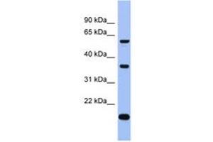 Image no. 1 for anti-La Ribonucleoprotein Domain Family, Member 6 (LARP6) (C-Term) antibody (ABIN6743023) (LARP6 antibody  (C-Term))