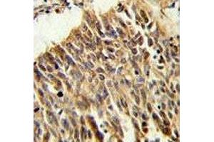 Immunohistochemistry (IHC) image for anti-Hypoxia Inducible Factor 1, alpha Subunit (Basic Helix-Loop-Helix Transcription Factor) (HIF1A) (AA 519-547) antibody (ABIN3031284)