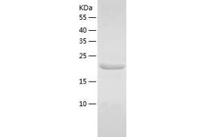 Western Blotting (WB) image for Ubiquitin-Conjugating Enzyme E2 Variant 1 (UBE2V1) (AA 2-170) protein (His tag) (ABIN7287092) (UBE2V1 Protein (AA 2-170) (His tag))