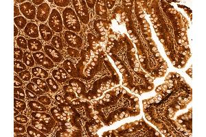 ABIN6259812 and ABIN6272986 at 1/100 staining Rat colon tissue by IHC-P. (ADRM1 antibody  (Internal Region))