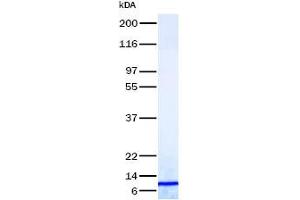 Validation with Western Blot (CXCL11 Protein)