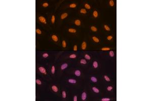 Immunofluorescence analysis of U-2 OS cells using KDM4B/JMJD2B Rabbit mAb (ABIN7268329) at dilution of 1:100 (40x lens). (KDM4B antibody)