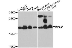 Western blot analysis of extracts of various cell lines, using RPS24 antibody (ABIN5998724) at 1:3000 dilution.