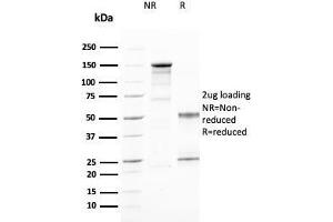 SDS-PAGE Analysis Purified CD25 Mouse Monoclonal Antibody (IL2RA/2394). (CD25 antibody  (AA 42-183))