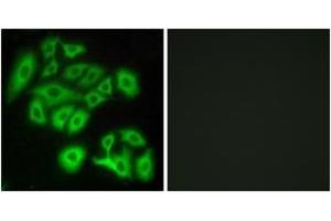 Immunofluorescence analysis of A549 cells, using FZD4 Antibody. (FZD4 antibody  (AA 131-180))