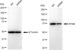 Western blotting analysis using PFKM antibody (ABIN7799801).