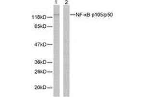 Western blot analysis of extracts from MDA-MB-435 cells, using NF-kappaB p105/p50 (Ab-337) Antibody. (NFKB1 antibody  (AA 304-353))