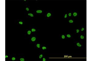Immunofluorescence of monoclonal antibody to MCM7 on HeLa cell. (MCM7 antibody  (AA 1-389))