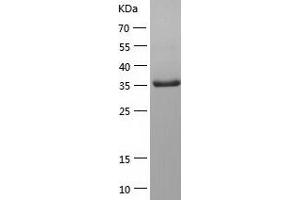 Western Blotting (WB) image for Mesoderm Development Candidate 1 (MESDC1) (AA 1-362) protein (His tag) (ABIN7123916) (MESDC1 Protein (AA 1-362) (His tag))