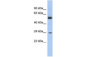 WB Suggested Anti-GSTM3 Antibody Titration: 0. (GSTM3 antibody  (Middle Region))