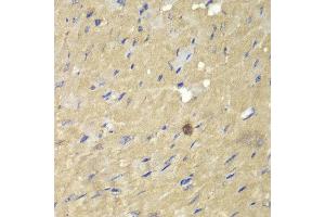 Immunohistochemistry of paraffin-embedded mouse heart using AKR7A2 antibody at dilution of 1:100 (400x lens).