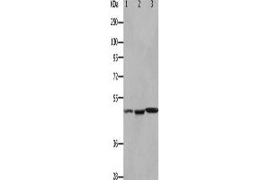 Gel: 10 % SDS-PAGE, Lysate: 40 μg, Lane 1-3: Mouse kidney tissue, Mouse brain tissue, Mouse heart tissue, Primary antibody: ABIN7190922(HCRTR2 Antibody) at dilution 1/1100, Secondary antibody: Goat anti rabbit IgG at 1/8000 dilution, Exposure time: 90 seconds (HCRTR2 antibody)