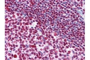 Immunohistochemistry (IHC) image for anti-Mdm4-binding Protein (MDM4) antibody (ABIN969282)