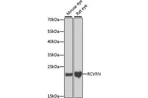 Western blot analysis of extracts of various cell lines, using RCVRN antibody (ABIN6128676, ABIN6146832, ABIN6146833 and ABIN6222036) at 1:1000 dilution. (Recoverin antibody  (AA 1-200))