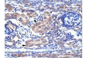 KCNAB3 antibody  (AA 81-130)