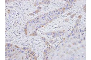IHC-P Image Immunohistochemical analysis of paraffin-embedded SCC15 xenograft, using TROVE2, antibody at 1:100 dilution. (TROVE2 antibody  (Center))